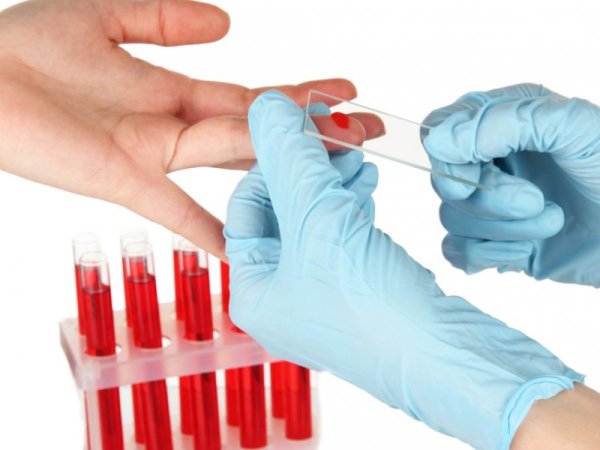 Анализ крови при тромбофилии